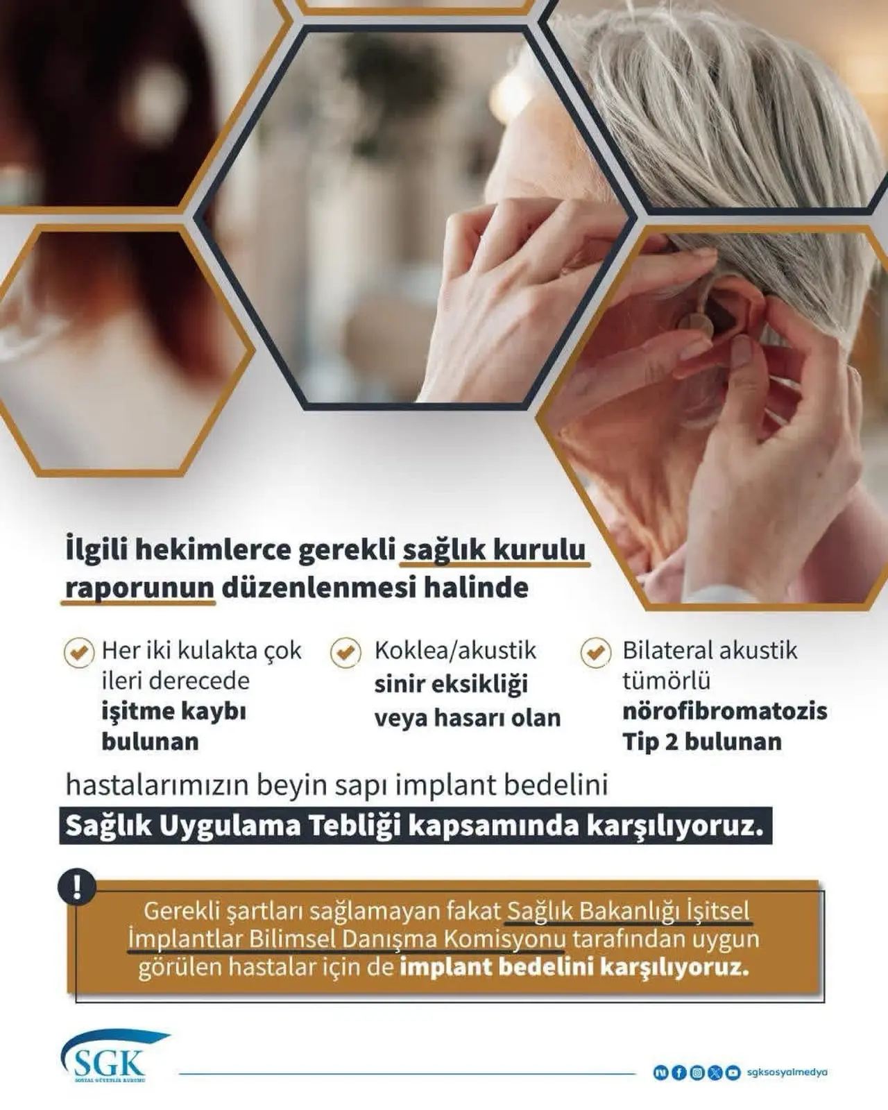 Beyin sapı implant bedeli hangi durumlarda karşılanıyor?