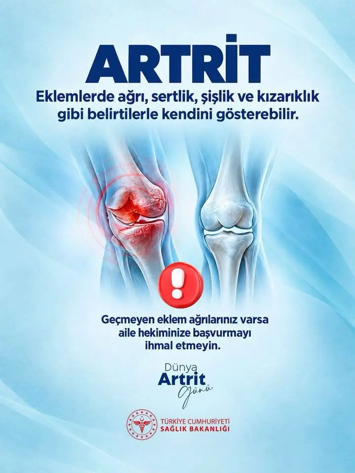 Kütahya Şehir Hastanesi'nden artrit uyarısı