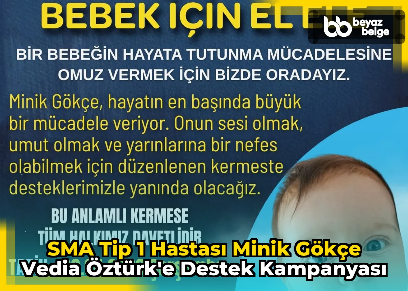 SMA Tip 1 hastası minik Gökçe Vedia Öztürk'e Destek Kampanyası