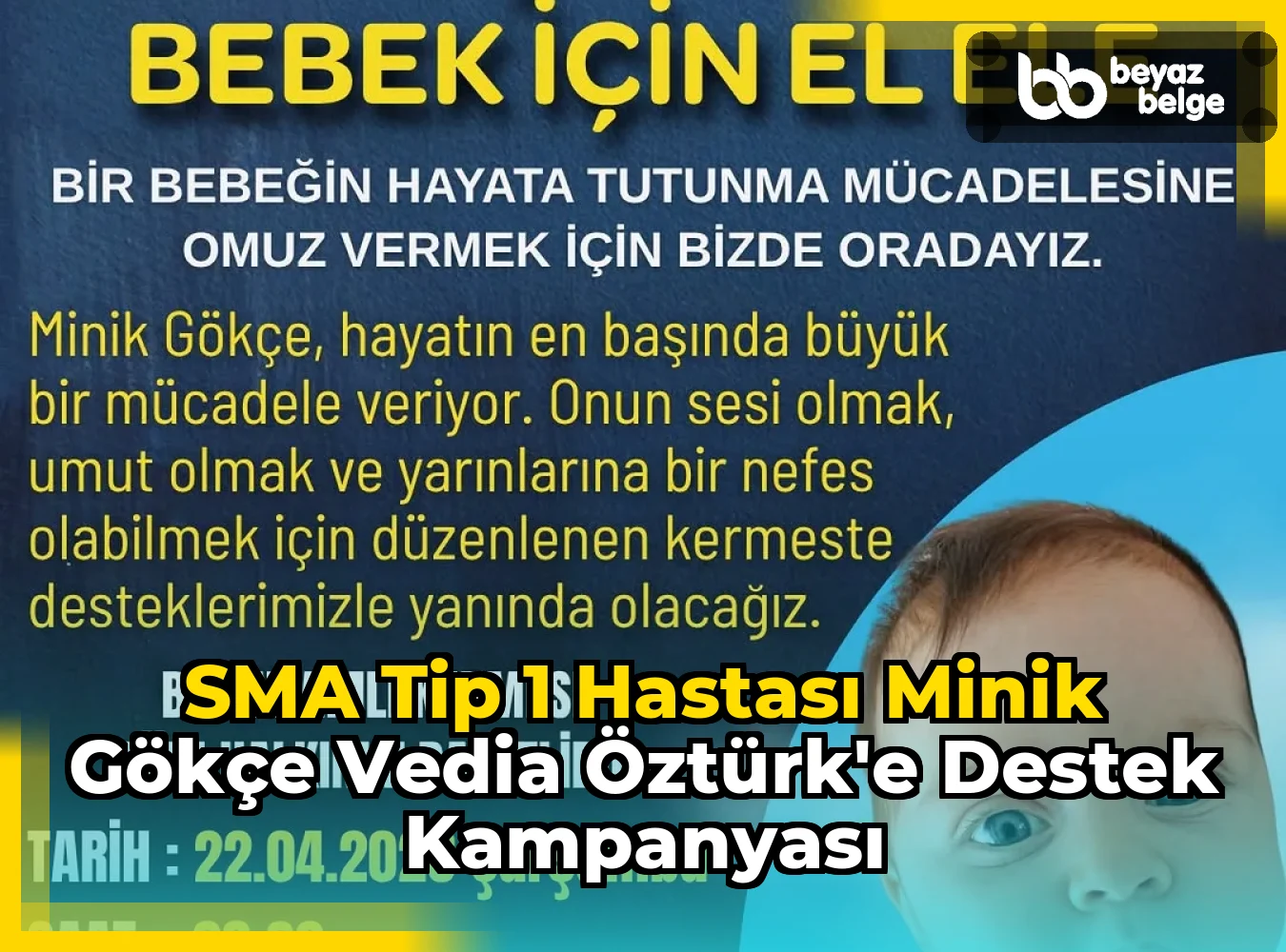 SMA Tip 1 hastası minik Gökçe Vedia Öztürk'e Destek Kampanyası