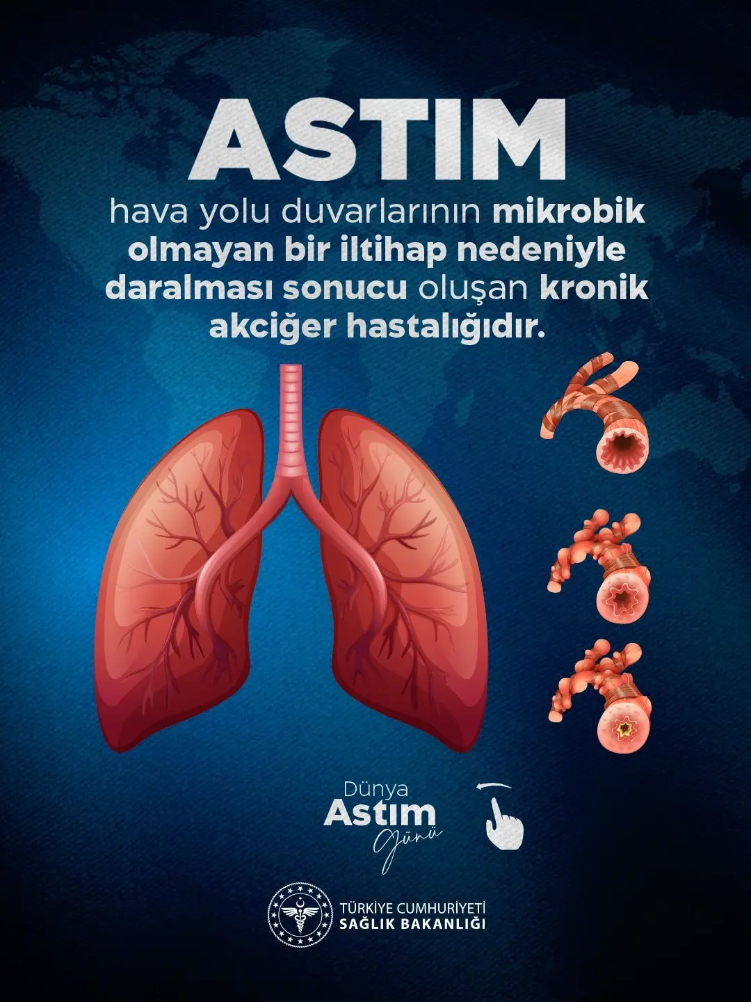 Astım kontrolü için 6 altın kural önerisi